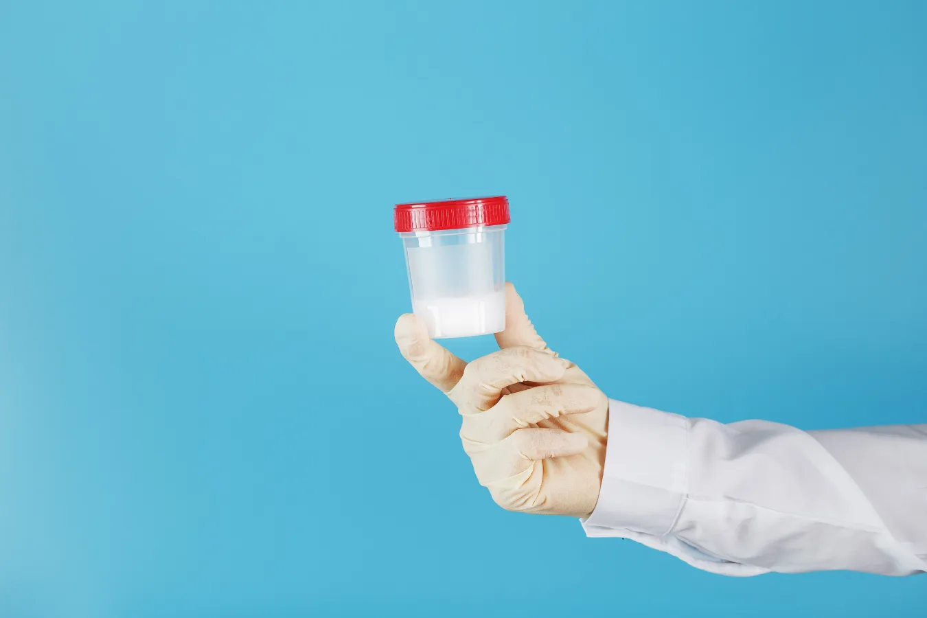 Profissional analisa amostra para investigação do espermograma
