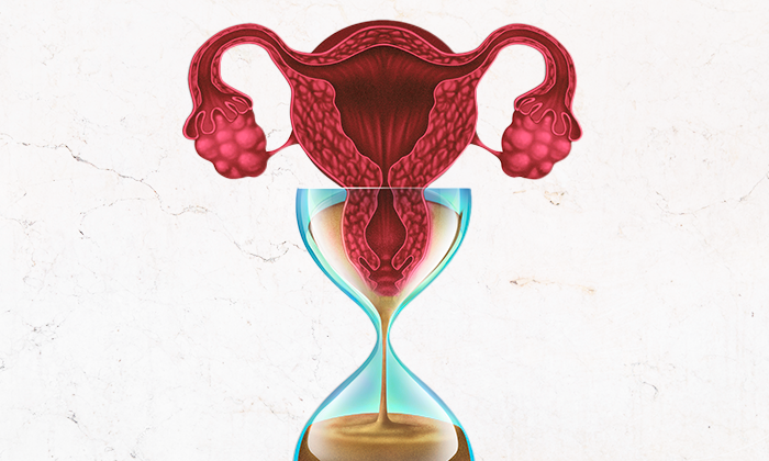 RESERVA OVARIANA X IDADE, entenda o impacto do tempo sobre a fertilidade feminina