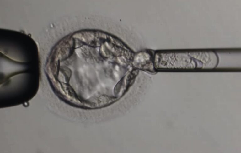 Biópsia Embrionária – Feliccita – Instituto de Fertilidade